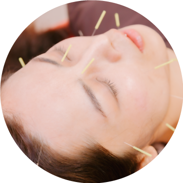美容鍼灸｜名古屋