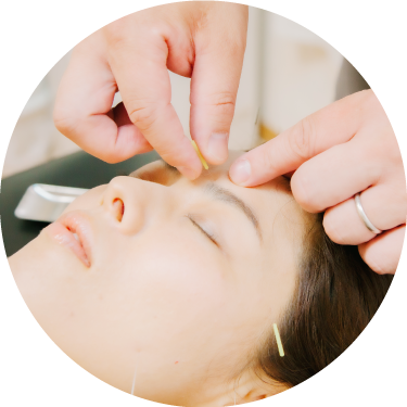 美容鍼灸