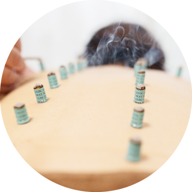 はりきゅう治療